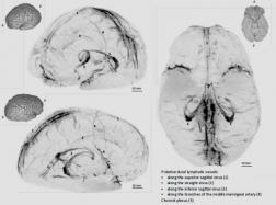 3D rendering of human dural lymphatics (curtesy of elifesciences.org)