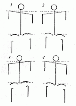 seitai-4-patterns.gif