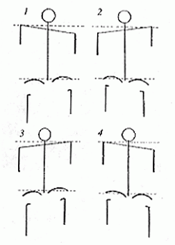 Four basic distortion patterns (from Introduction to Seitai Shinpo by Sorimachi Dai-ichi: NAJOM Vol. 9, No. 25, p. 13)